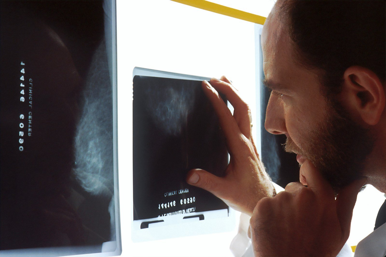 Diploma in X Ray Technology